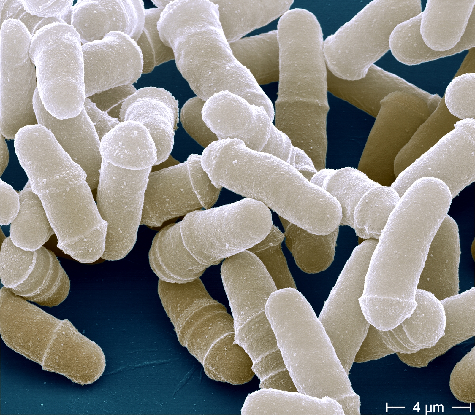 Представитель Класса Schizosaccharomycetes